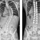 스포메드짐 이미지