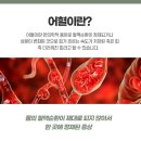 골든한의원 이미지