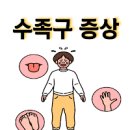 아기 수족구 초기 증상 원인 진단 치료 목욕 약 입안 이미지