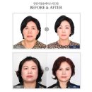 압구정페이스라인성형외과의원 이미지