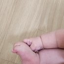 굳센병원 | 대구소아정형외과 굳센병원 후기 (영유아검진 사타구니 주름 비대칭)