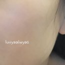 솔향메디 네이버블로그