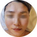 장안로52번길 | 분당 피부테라피/ 피부관리/ 모공관리 고원장의모공세척테라피 분당점 방문후기