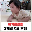 세븐일레븐 동국대제일병원점 | 아기 혈관종 3개월 치료 경과 후기 (feat.동국대일산병원)