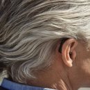 스마트히어링 보청기 이미지