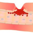 스테이 후 이미지