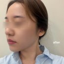 단비스킨케어 | 광주 상무지구 피부관리 잘하는 르헤브스킨케어 페이스디톡스 솔직 후기