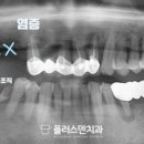 플러스덴치과의원 이미지