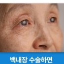 탑플러스안과의원 네이버블로그