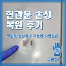 광명파란문약국 | 현관문 손상 복원 후기, 찍힘도 원상복구 가능한 파란장갑