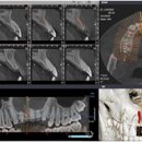 수플란트 이미지
