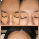 피부하우스 이미지