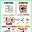 자연안에한의원중구점 네이버블로그