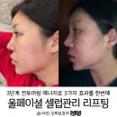 셀럽 | 청담피부과 울페이셜 피부리프팅 셀럽관리 후기