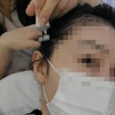 하루두피 광주첨단신창점 이미지