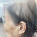 렉스톤 보청기 양천지사 이미지