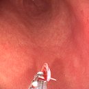 장새로내과의원 이미지