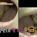 아당 이미지