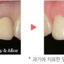 모치과기공소 이미지