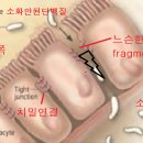 작은창자=소장=Small intestine 이미지