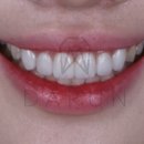 웃음치과기공소 이미지