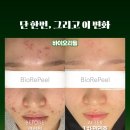 바이오에스테 이미지