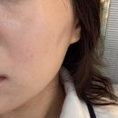 백설공주피부관리실 | 장안동 피부관리 맑아지는 피부(바나나부띠끄) 백설공주 케어 후기