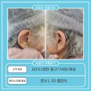 삼성생명맞은편(포낙보청기 앞) | 서XX고객님 포낙 루미티 50 충전식 구매후기(80대,女)