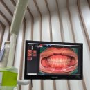 남양좋은치과의원 | 스케일링 비용(외래 진료비 경감 혜택) /동래 온천장 명륜동 치과 좋은하루치과의원 후기 / 임산부 코피