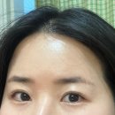 경기도 수원시 팔달구 경수대로 437 (인계동) | 수원 인계동 페더링 눈썹문신 반영구 피씨엘코리아 잔흔 후기