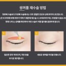 바나나성형외과의원 이미지