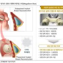 [무릎바이오] 무릎관련기업 공부해보기 5 - 엘앤씨바이오 25.6.6