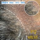 창동 두피문신 탈모고민 싹 다 해결해드립니다 (+두피문신가격)