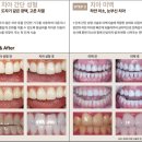 트리덴탈 이미지