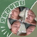 모이라이 | 천안아산피부관리 끝판왕! 모이라이뷰티 리얼후기