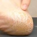 딱풀통신 이미지