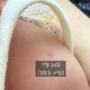 성애의료재단 | 신생아 결핵(BCG) 예방접종과 병원 찾는 방법(feat. 한강성심병원 피내용 접종 후기)