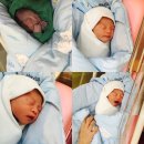 미래안산부인과 제왕절개 입원 :)