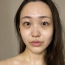 정미경 에스테틱 | 여의도 피부관리 / 정미경에스테틱 성형윤곽관리 받고온 후기