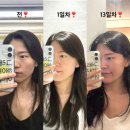 리즈멍 | 대구스킨부스터 리즈네, 대구피부과 힐로웨이브 대만족 후기