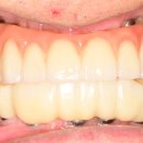 아치치과기공소 이미지