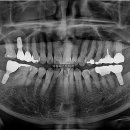 퍼스트 치과기공소 이미지