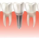 중산사과나무치과병원 이미지
