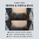 헤어라인 | 양산두피문신, 양산헤어라인문신 후기