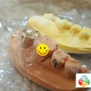 원데이수치과의원 이미지