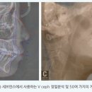 미소하나치과의원 이미지