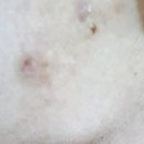 구행쑥뜸 - 세종특별자치시 용포로 87-8 | 구행쑥뜸