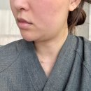 [Beauty] :: 청담피부과 온다리프팅 후기 | 턱 라인 고민이시라면 여기로..