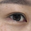 원진 | 병풀크림 추천 닥터원진플러스 후기