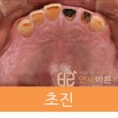 연세위치과의원 네이버블로그